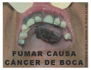 Peru 2008 Health Effects Mouth - mouth cancer, graphic